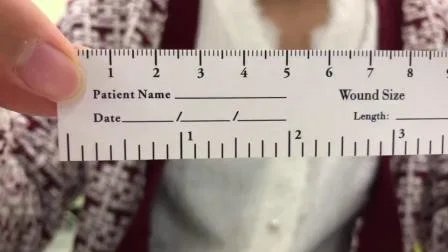 Fita métrica para feridas descartável médica para impressão de produto de papel de venda imperdível